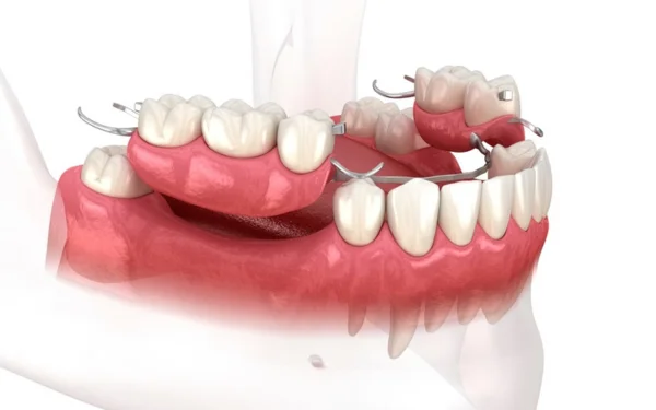 merikes-odontostoixies-optimized